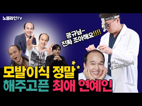 모발이식의사가 너무나 수술 해주고싶은 최애 연예인, 우리 김광규 배우님!