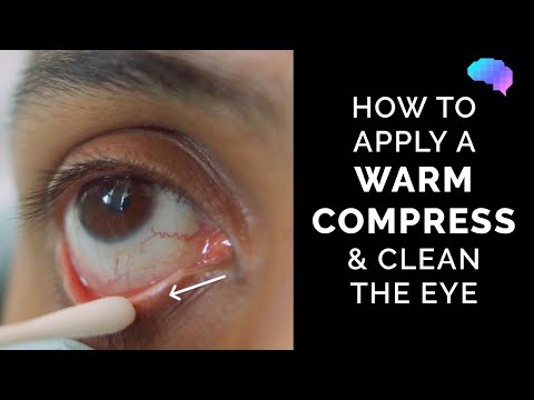 How to Apply a Warm Compress & Clean the Eye | Eye First Aid | OSCE Guide
